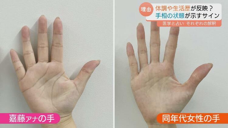 手相が変わる」ってホント？ 運勢をみるだけじゃない！手相が示す健康