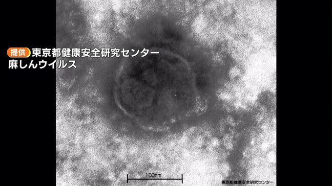 空気感染する「はしか」今後の広がりに注意を　福岡県では8月に5人が発症　すでに二次感染も|TBS NEWS DIG