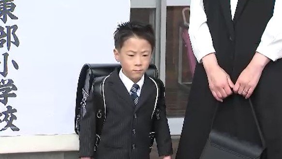 世界最小」の男の子…身長22センチ体重258グラムで誕生、関野竜佑くん