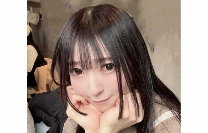 陣内智則さんの姪・ご当地アイドル・宮脇舞依さん　額の腫瘍を手術　「無事ツノ(腫瘍)は無くなりました」|TBS NEWS DIG