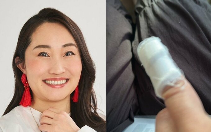 【 キンタロー。 】　火傷で病院に「2度だった」　「R1準決勝だめで落ち込んでいたら」「素手で熱々の鍋の蓋を持つと言う失態を」　「めちゃくちゃ火傷痛いので」うずくまる|TBS NEWS DIG