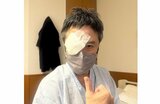 錦織一清さん 目を手術 「ひとまず成功です!」 力強いポーズで報告|TBS NEWS DIG