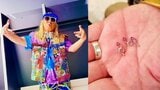 【DJ KOO】9.8mmの脳動脈瘤で「6時間半の開頭手術」と9年前の今日を振り返り 今は「何の後遺症もなく 今も元気にDJが出来てます!」「健KOO第一!!」|TBS NEWS DIG
