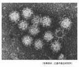 「冬だけでなく夏にも起きる可能性ある」 刺身盛りでノロウイルス集団食中毒　広島市の飲食店で４人に下痢･おう吐など|TBS NEWS DIG