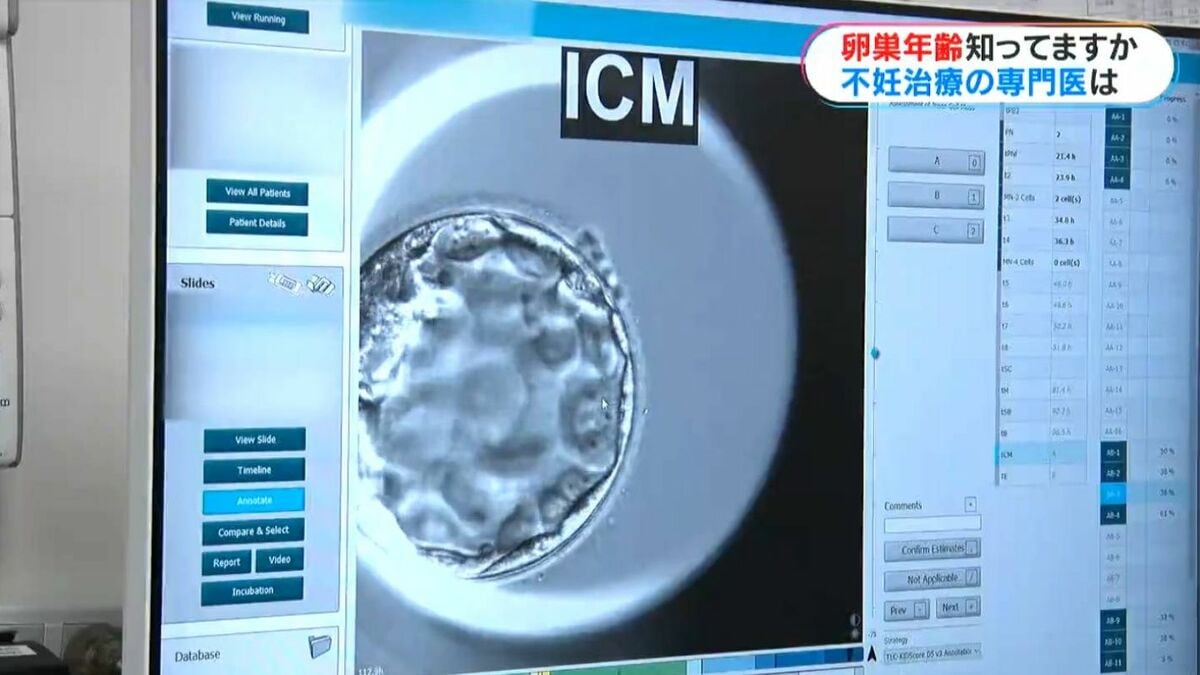 卵巣年齢知っていますか？まずは自分の身体を知って」不妊治療専門医に