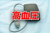 病院で測ってもらって血圧が「上がる人」と「下がる人」 知っておきたい「白衣」と「仮面」2つの高血圧 | 静岡のニュース | SBSNEWS | 静岡放送