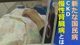 「新たな国民病」CKD 推計患者は成人の8人に1人「自覚症状が出たころには手遅れということも」 | 山梨のニュース | UTYテレビ山梨