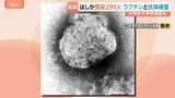 去年すでに上回る「はしか」感染299人　都内小学校では「学年閉鎖」も　厚労省はワクチン2回接種を呼びかけ|TBS NEWS DIG