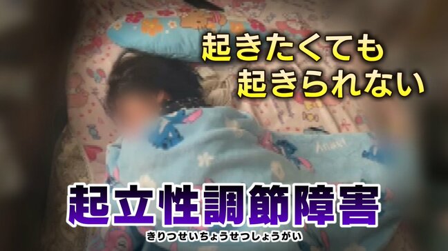 「朝起き上がれない…」“なまけ” と誤解されやすい起立性調節障害 不登校の児童生徒の約4割が苦しむ 適切な理解と支援を|TBS NEWS DIG