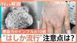 はしか「発症の1日前から感染力」「風邪のような症状のあとに発疹」26～53歳は特に注意！ワクチン接種歴の確認を【Nスタ解説】|TBS NEWS DIG