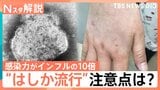 はしか「発症の1日前から感染力」「風邪のような症状のあとに発疹」26～53歳は特に注意！ワクチン接種歴の確認を【Nスタ解説】|TBS NEWS DIG