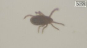 【感染者増加中】マダニによる『日本紅斑熱』 76歳男性が頭痛などで入院　熊本県内での感染確認は“今年初”　|TBS NEWS DIG