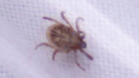 『マダニの感染症(SFTS)で女性が死亡』 “腕の黒いカサブタ” に気づき病院で受診するも・・・|TBS NEWS DIG