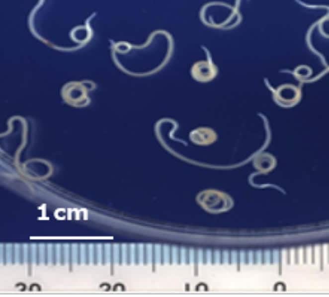 クルマダイの刺身を食べて腹痛・嘔吐 原因は“白色の少し太い糸のようなもの”|TBS NEWS DIG