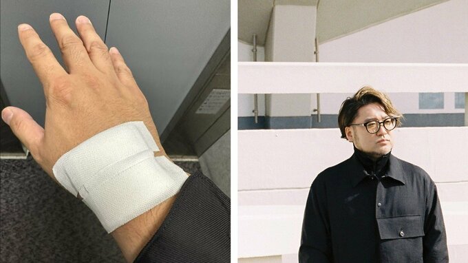 Base Ball Bearドラム　堀之内大介さん　ガングリオン除去を報告　「ドラム叩いて大丈夫とのことで安心してます」|TBS NEWS DIG