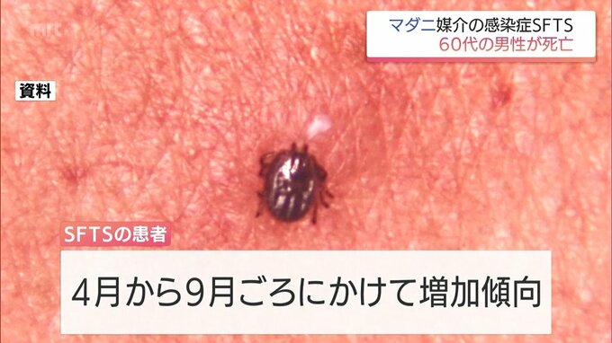 マダニが媒介する感染症「SFTS」　宮崎県内で男女2人が感染　60代男性が死亡|TBS NEWS DIG