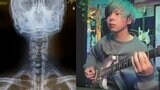 首の痛みは「頚椎症」 …自身の「ライブ中のヘドバンが主な原因と考えられる」　ロックバンド【Another Story】　寛-hero-さんが警鐘　　「バンドマンならなり得そうな理由だから　みんなも気をつけてね、、」|TBS NEWS DIG