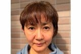 【 がん闘病 】古村比呂さん「蕁麻疹がポツポツと発生」「処方された抗生剤の薬アレルギーでした」|TBS NEWS DIG