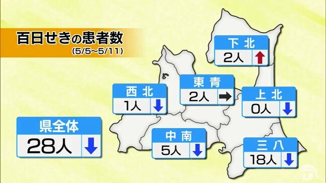 「百日せき」青森県で2週連続減少も依然例年より多い状況　5月11日までの1週間で患者は28人|TBS NEWS DIG