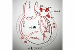 同時に併発?「冠動脈瘤」と「心タンポナーデ」とは?~『ブラックペアン』監修ドクターが解説 vol.14~|TBS NEWS DIG