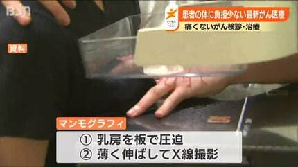 痛くない」乳がん検診を記者が体験 患者にやさしい最新がん医療