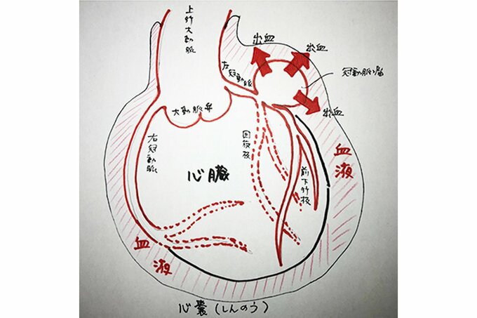 同時に併発？「冠動脈瘤」と「心タンポナーデ」とは？～『ブラックペアン』監修ドクターが解説 vol.14～|TBS NEWS DIG