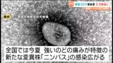 新型コロナ感染拡大 前週の2.5倍超に 新たな変異株「ニンバス」流行も影響か 宮城 | 宮城のニュース│tbc NEWS│tbc東北放送