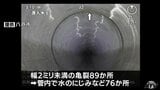 青森県八戸市の下水道管574mが「緊急度I」で原則1年以内に速やかな対策が必要と判断 埼玉県八潮市で発生した道路陥没を受けて全国で実施の調査 | 青森のニュース│ATV NEWS│青森テレビ