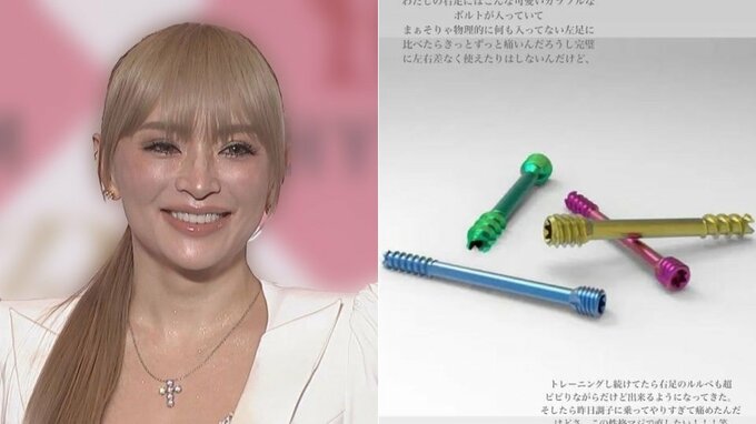 【浜崎あゆみ】右足にボルトでも「継続は力なり」　トレーニング ”やりすぎて痛めた笑”|TBS NEWS DIG