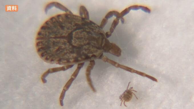 10代女性がマダニにかまれ感染症「SFTS」発症 野外活動中にかまれたか | 愛媛のニュース - Nスタえひめ|あいテレビは6チャンネル