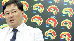 「気のせいにさせたくなかった」研究支えたクラウドファンディングとチームの思い「ブレインフォグ」治療の糸口掴む横浜市立大学の臨床研究| TBS CROSS DIG with Bloomberg