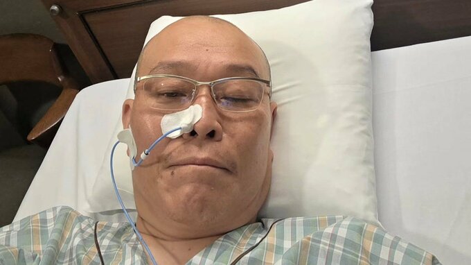 【千原せいじ】『肝膿瘍破裂』のため手術を報告「手術無事成功。今回は心底ビビった」|TBS NEWS DIG