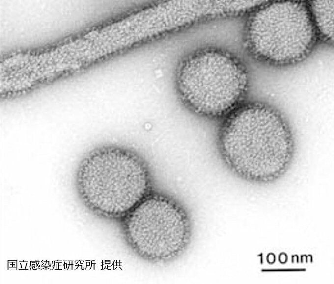 広島市でインフルエンザが “流行入り”　目安の患者数上回る「手洗いやせきエチケットを」広島|TBS NEWS DIG
