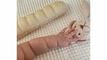 赤ちゃんの腕、ムチムチ「ちぎりパン」が…体型維持のヒントに？　医師が注目する理由　|　BSSニュース | BSS山陰放送