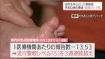 幼児を中心とした感染症「手足口病」　宮崎県内の患者数は前週比1.69倍　3週連続で流行警報レベル超|TBS NEWS DIG