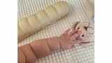 赤ちゃんの腕、ムチムチ「ちぎりパン」が…体型維持のヒントに？　医師が注目する理由　|　BSSニュース | BSS山陰放送