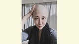 【がん闘病】西丸優子さん「とても不安なこと」「抗がん剤で白髪になってしまったのでしょうか」|TBS NEWS DIG