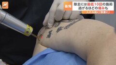 “痛みで逃げ出す人も” 韓国でタトゥー除去が増加　その背景に社会の変化 人口の4分の1がタトゥーを入れたとの推計| TBS CROSS DIG with Bloomberg