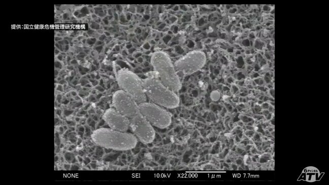 「百日咳」の感染拡大 青森県内の患者数は46人で過去最多を更新|TBS NEWS DIG