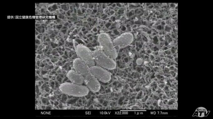 「百日咳」の感染拡大　青森県内の患者数は46人で過去最多を更新|TBS NEWS DIG