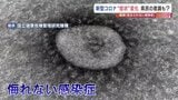 新型コロナ5類移行から2年…今も侮れない その特徴は? インフルは「夏流行」 | 熊本のニュース|RKK NEWS|RKK熊本放送