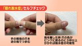 見分けるには『爪を押す』隠れ脱水症に注意 意識しないと1.2リットルの水分不足 | 福島のニュース│TUF