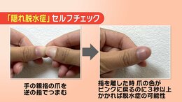 見分けるには『爪を押す』隠れ脱水症に注意　意識しないと1.2リットルの水分不足|TBS NEWS DIG