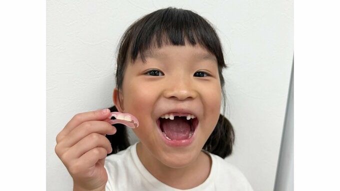 【ののちゃん】「かっこいい〜！」初めての仮歯に大喜び　歯医者での不安から笑顔へ変わる成長の瞬間|TBS NEWS DIG