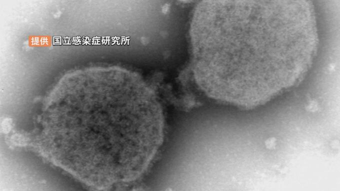 「RSウイルス」国内の60歳以上、年間4000人死亡との推定…重症化し肺炎も　ワクチンが国内初承認　|　BSSニュース | BSS山陰放送