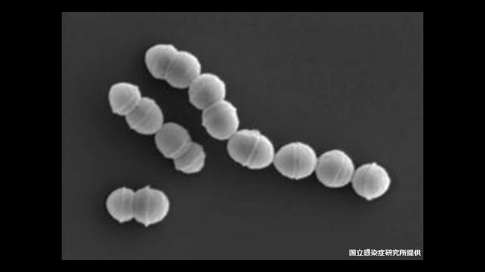 児童に多く春から初夏にも流行ピーク　A群溶血性レンサ球菌咽頭炎（溶連菌感染症）　広島県に警報|TBS NEWS DIG