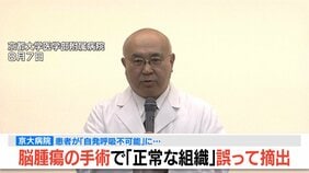 【速報】脳腫瘍手術で「正常な組織」を誤って摘出…自発呼吸不能の重篤状態に　「腫瘍でない」結果出ても“勘違い”で摘出継続　通常の生活送っていた患者が手足も動かず　京大病院|TBS NEWS DIG