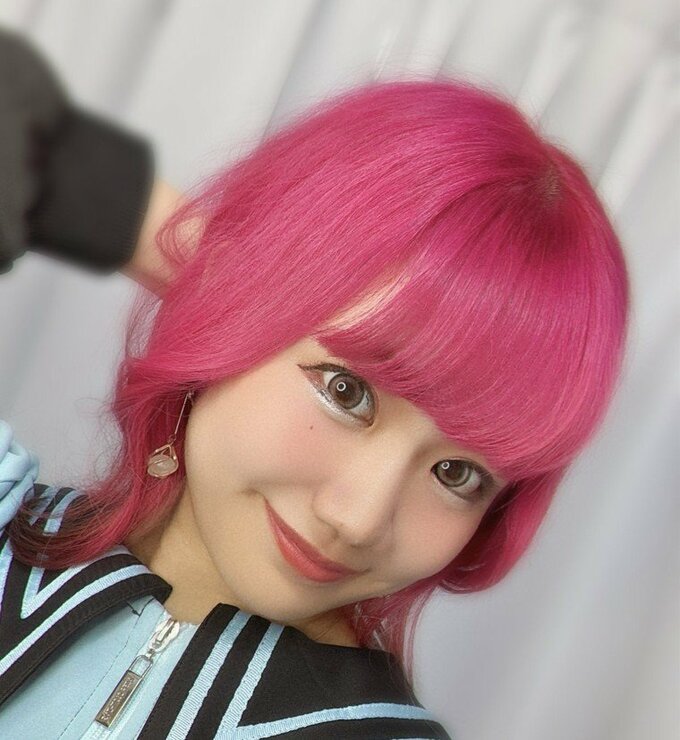 【 シンガーソングライター・すみれ 】 「小腸に5cm大の粘膜下腫瘍が」　ＳＮＳで明かす　「腹腔鏡手術(場合によっては開腹手術)で切除することとなりました!」|TBS NEWS DIG