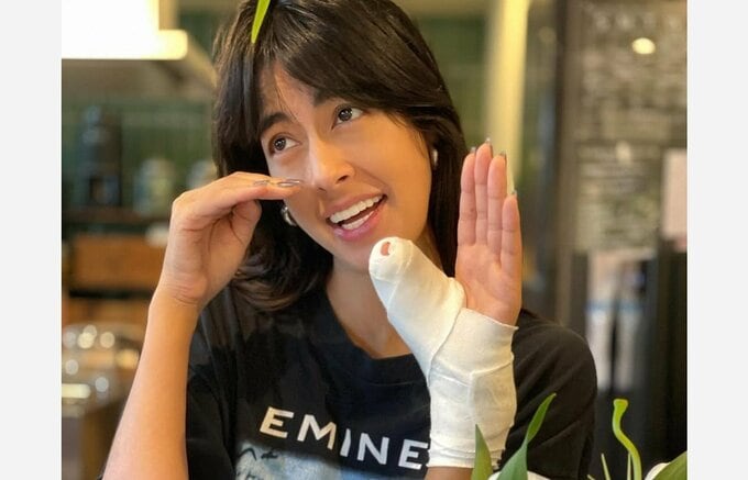 【 森泉 】 「すべって親指さしちゃって」「腱が切れてて手術することに」　包帯姿にファン反響　「痛々しぃ　早く良くなりますように」|TBS NEWS DIG