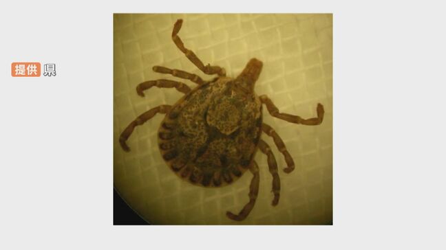 70代男性がマダニにかまれウイルス感染で入院 県が長ズボン着用など注意呼びかけ 大分|TBS NEWS DIG